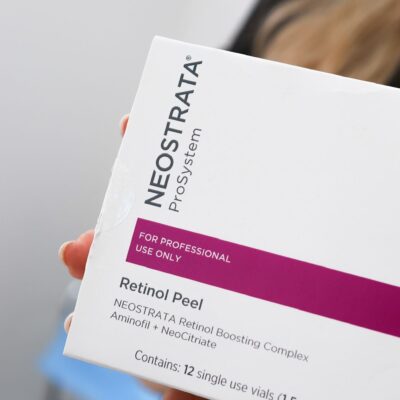 Is Retinol Peel Effective For Treating Sun Spots In Kingston Upon Thames